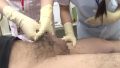 短小・包茎・早漏のお悩み相談 泌尿器科のナースのお仕事